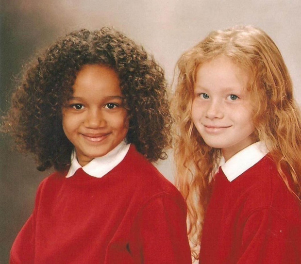 Cặp chị em sinh đôi “khác nhau nhất thế giới” trái ngược từ màu da đến mái tóc từng gây xôn xao khó hiểu giờ trông thế nào sau 25 năm? - Ảnh 3.