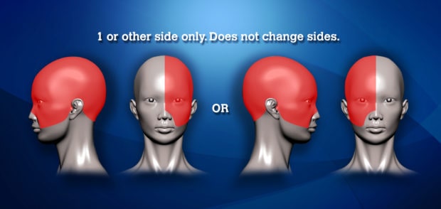 The world is getting more and more headaches: More than 1 billion people find every day a headache for them - Photo 5.