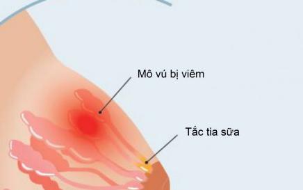 Công dụng chữa bệnh từ diếp cá - Ảnh 2.