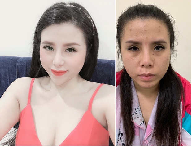  Dàn hot girl vướng vòng lao lý vì buôn ma túy: Tạo vỏ bọc sang chảnh giàu có, khoe ảnh gợi cảm và hay nói đạo lý trên MXH - Ảnh 1.