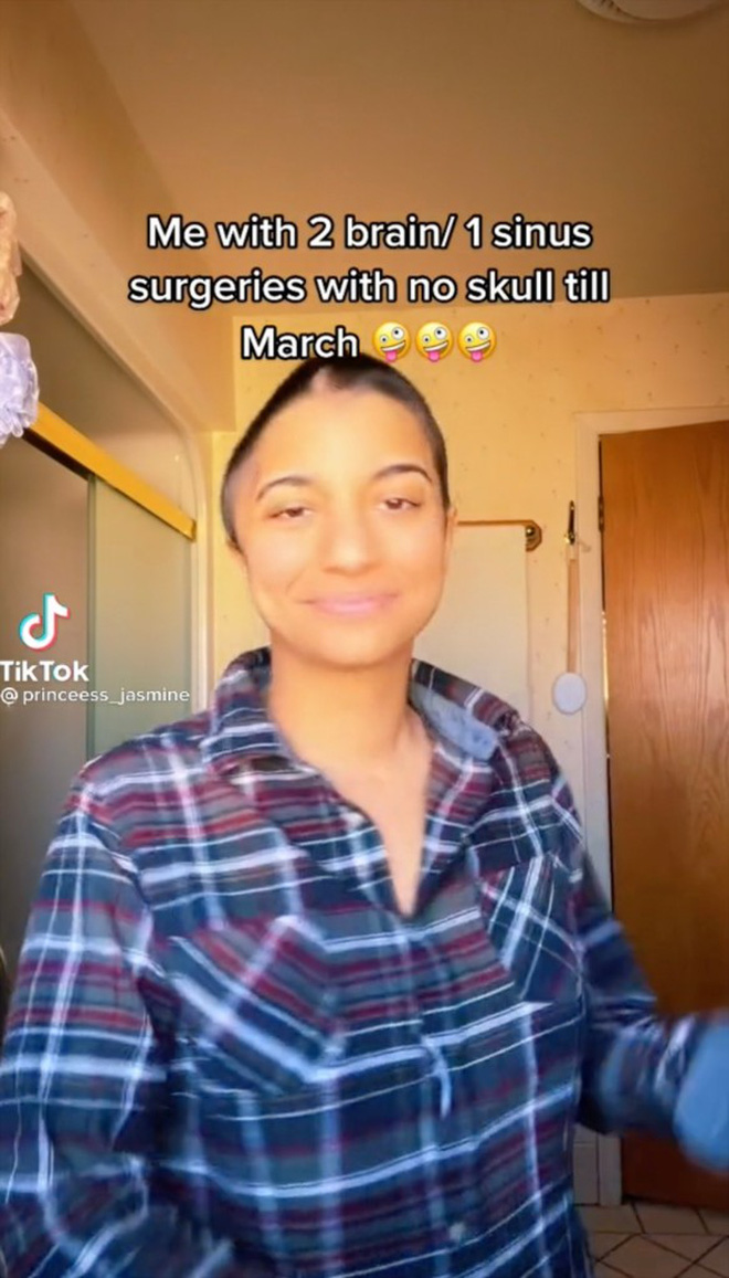 Cô gái 25 tuổi phải cắt nửa hộp sọ, suýt mất mạng chỉ từ một triệu chứng nhỏ ai cũng gặp - Ảnh 5.