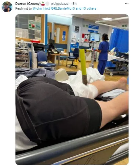 Kinh dị VĐV bị cột cờ đâm thủng đầu gối, nhưng thần thái tưng tửng của anh chàng còn đáng chú ý hơn - Ảnh 2. Kinh dị VĐV bị cột cờ đâm thủng đầu gối, nhưng thần thái tưng tửng của anh chàng còn đáng chú ý hơn - Ảnh 2.