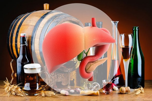 Jaundice, fatigue, loss of appetite… Be careful with alcoholic cirrhosis - Photo 2.