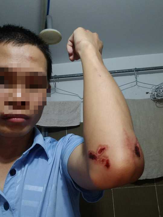   Technology car driver was brutally attacked near Mien Tay Bus Station - Photo 2.