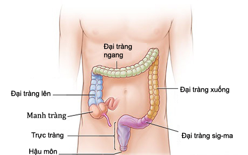 Ung thư đại trực tràng: Ai dễ mắc, cách nào phòng tránh? - Ảnh 2.