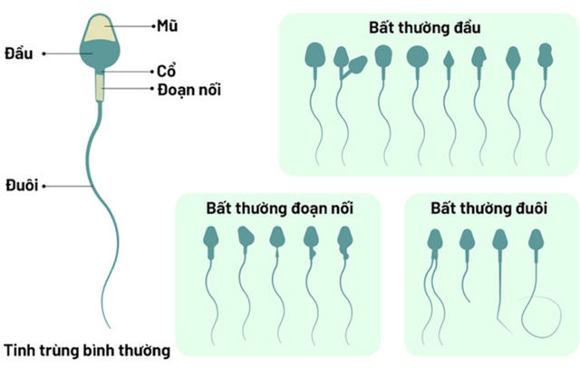 Hình dạng tinh trùng nào có khả năng thụ tinh hiệu quả nhất? - Ảnh 2.