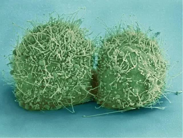 Tế bào ung thư này đã được nuôi dưỡng suốt 70 năm, riêng khối lượng thu về đã hơn 50 triệu tấn  - Ảnh 6.