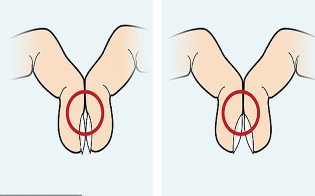 Khoảng trống kim cương ở ngón tay: Bài kiểm tra đơn giản cảnh báo nguy cơ mắc ung thư phổi - Ảnh 1.