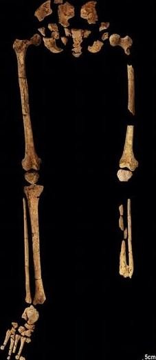 Phát hiện bằng chứng ca phẫu thuật chân sớm nhất trong lịch sử - Ảnh 2.