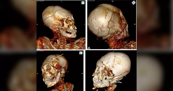 Phát hiện chấn thương trên xác ướp Nam Mỹ 1.000 năm tuổi, nạn nhân của những vụ giết người tàn bạo? - Ảnh 1.