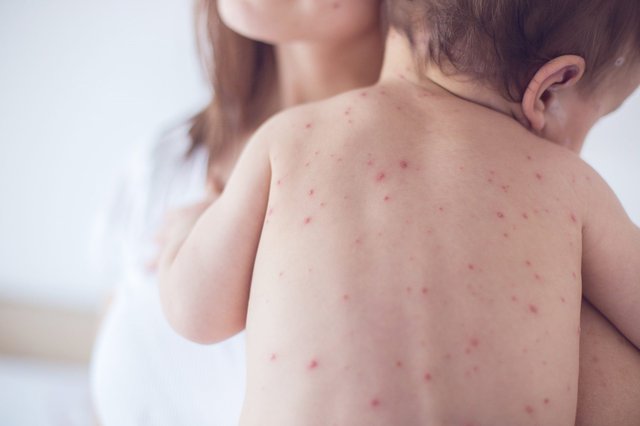 Nguy cơ sức khoẻ “rình rập” trẻ mùa tựu trường: Chuyên gia chỉ mẹo bảo vệ trẻ, cha mẹ cần lưu ý