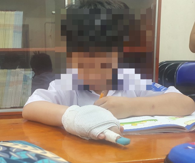 Cơ quan chức năng vào cuộc vụ giáo viên bị tố đánh gãy xương ngón tay học sinh - Ảnh 1.