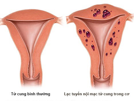 Bệnh khó nói: Cứ gần gũi chồng là đau - Ảnh 4.