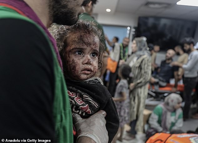 Những bức hình ám ảnh tại bệnh viện Gaza bị tấn công: Ánh mắt hoảng sợ tột cùng của những đứa trẻ vô tội - Ảnh 9.