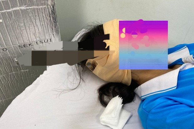  Nữ sinh bị lưỡi dao găm vào đầu khi ngồi uống nước trong sân trường - Ảnh 1.