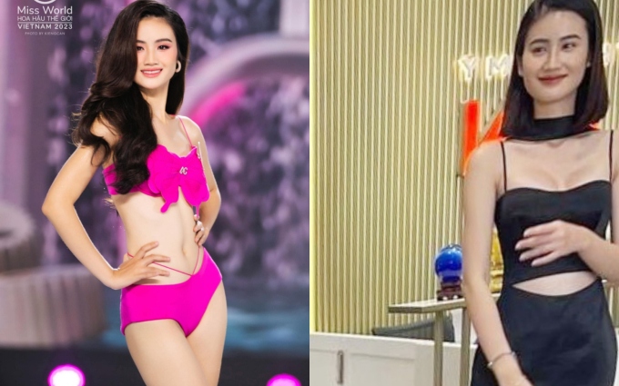 Hoa hậu Ý Nhi bị team qua đường bắt gặp trước khi đi Úc du học 2 năm: Vướng nghi vấn “dao kéo”, thái độ đáng bàn - Ảnh 2.