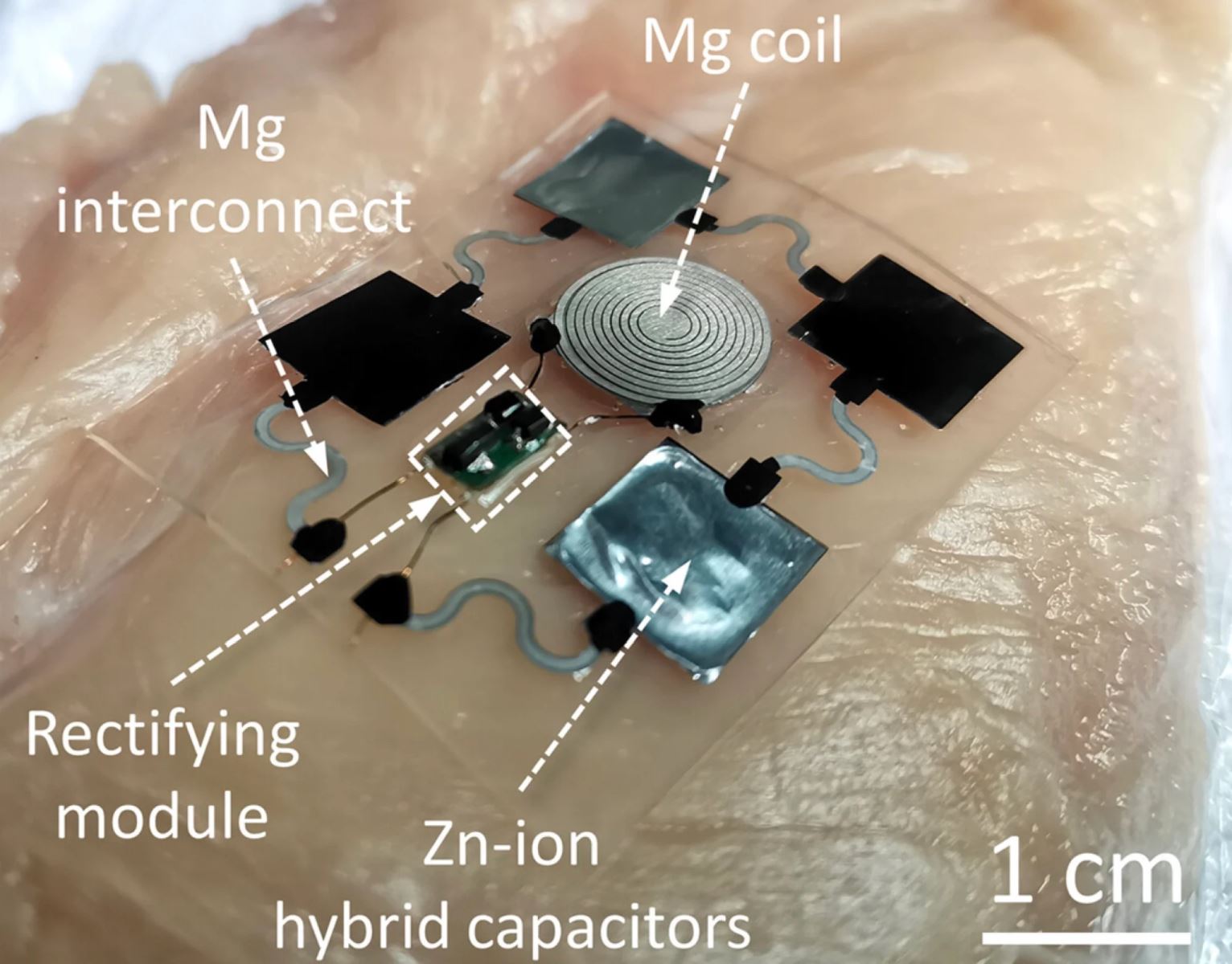 Trung Quốc phát triển sạc không dây cấy trong cơ thể người - Ảnh 2.