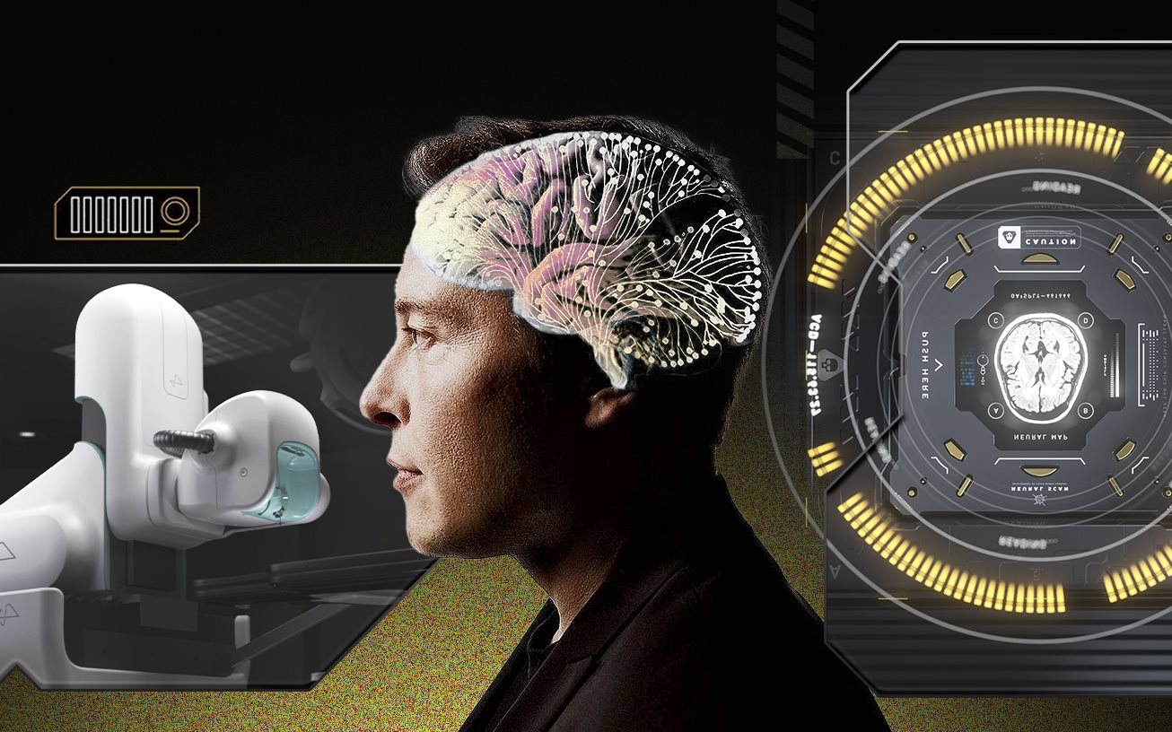 Giấc mơ cấy chip vào não người điên rồ của Elon Musk: Tự chế tạo robot phẫu thuật, sẽ thực hiện hơn 22.000 cuộc giải phẫu vào năm 2030, chi phí mỗi ca 10.000 USD - Ảnh 1.
