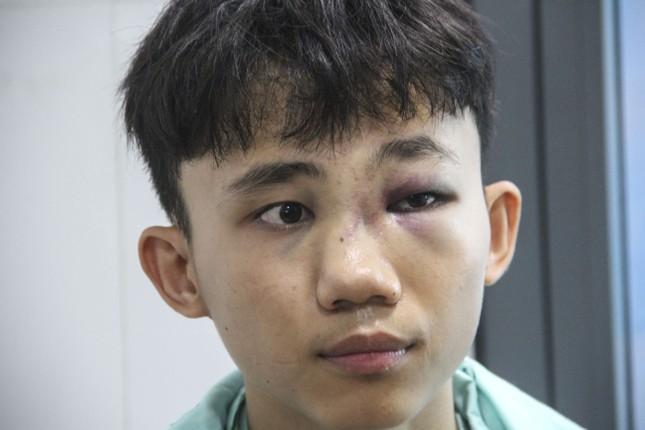 Bình Định: Học sinh lớp 10 bị đánh hội đồng nhập viện- Ảnh 1.