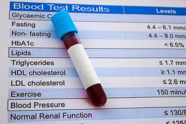 Cholesterol tốt quá cao cũng đáng lo - Ảnh 1.