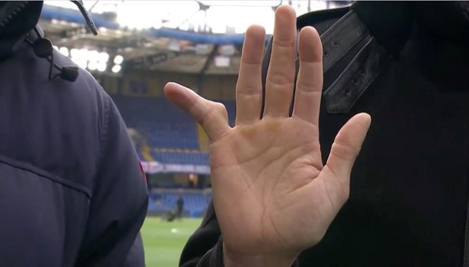 Sau khi chơi gần 700 trận, cựu thủ môn gây ngỡ ngàng khi tiết lộ hình ảnh ngón tay út- Ảnh 2.