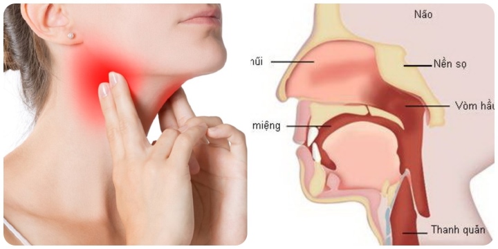 Dấu hiệu ung thư vòm họng ở phụ nữ - Ảnh 1.