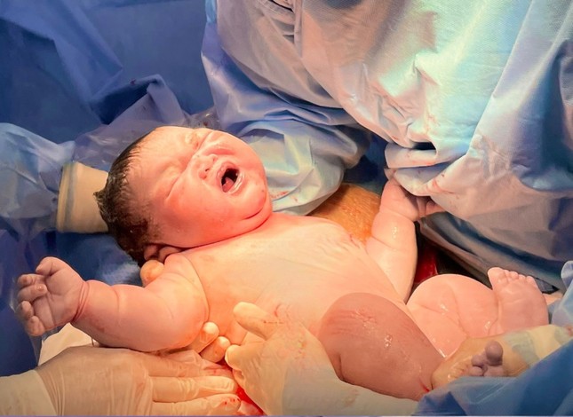 Bé trai vừa chào đời nặng 5,8 kg ở TPHCM - Ảnh 1.