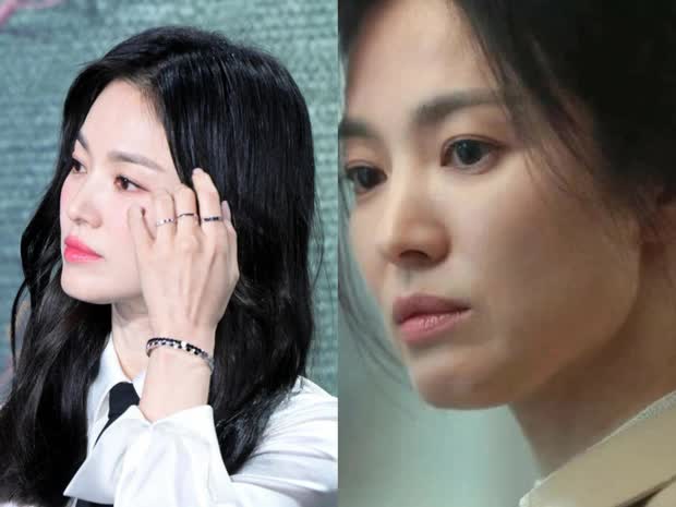  Song Hye Kyo và ác nữ xuống cấp từ nhan sắc đến sức khoẻ vì The Glory  - Ảnh 3.