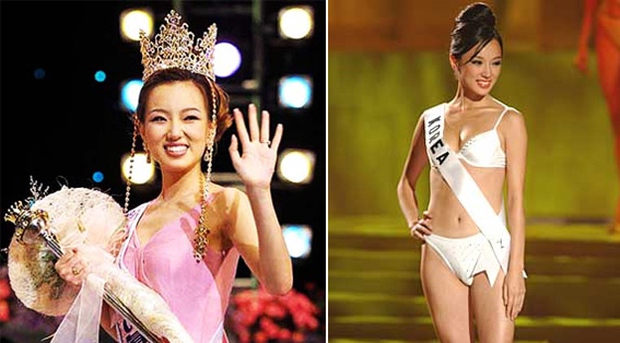 Hoa hậu Hàn Quốc chi gần 15 tỷ đồng phẫu thuật thẩm mỹ toàn thân, kéo dài chân thêm 20cm từ 1m5 thành 1m7? - Ảnh 2.