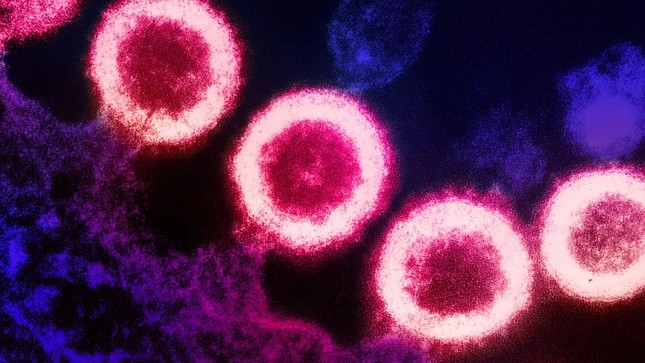 Thông tin thêm về người phụ nữ đầu tiên được ghép tế bào gốc chữa khỏi HIV - Ảnh 1.