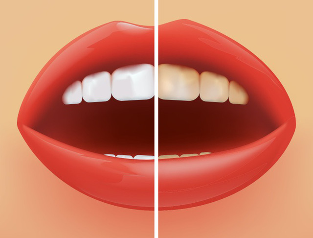 6 mẹo đơn giản giúp bạn chăm sóc răng miệng sạch sẽ - Ảnh 5.