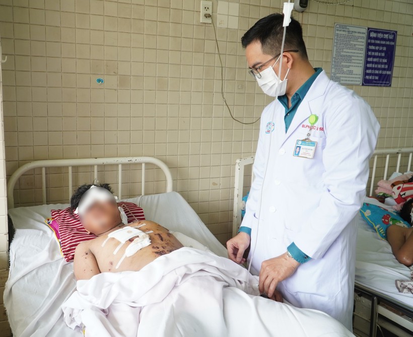 Một học sinh tử vong vì tự chế pháo nổ - Ảnh 1.