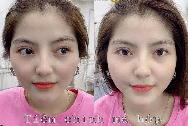 Dung mạo của Chu Thanh Huyền trước khi gặp Quang Hải  - Ảnh 2.