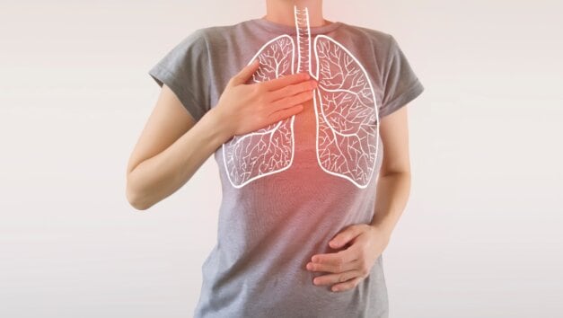 3 triệu chứng nghiêm trọng cảnh báo ung thư phổi - Ảnh 1.