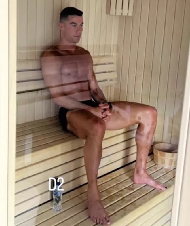 The mystery of Cristiano Ronaldo's black painted toenails - Photo 1.