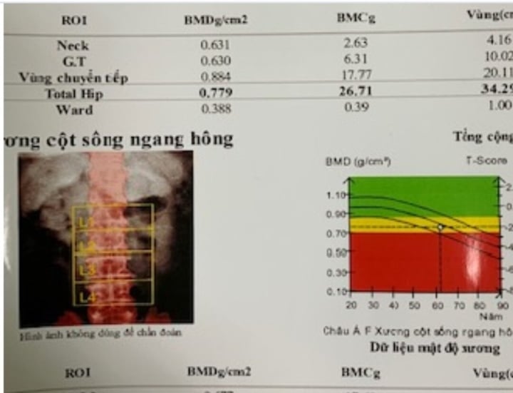 Tự ý mua thuốc điều trị, bác sĩ chỉ ra hậu quả khôn lường - Ảnh 1.