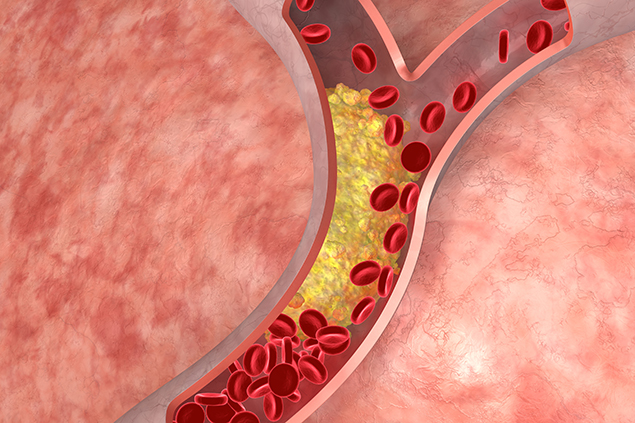 5 hành động là khắc tinh của mỡ máu, làm đúng chẳng sợ cholesterol cao - Ảnh 1.