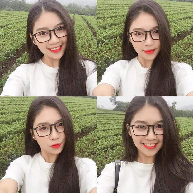 Lan truyền hình ảnh trước khi phẫu thuật thẩm mỹ của “bản sao Phạm Băng Băng” - Ảnh 4.