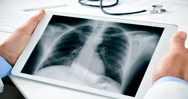 2 yếu tố gây tổn thương phổi quẩn quanh người Việt: Điều số 1 nhiều người thích mê - Ảnh 1.