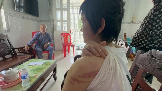 Thai phụ bị chồng bạo hành và cuộc tháo chạy khỏi địa ngục - Ảnh 1.