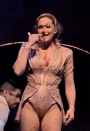 Nữ ca sĩ Đức bị rạch mặt gây sốc trên sân khấu - Ảnh 1.