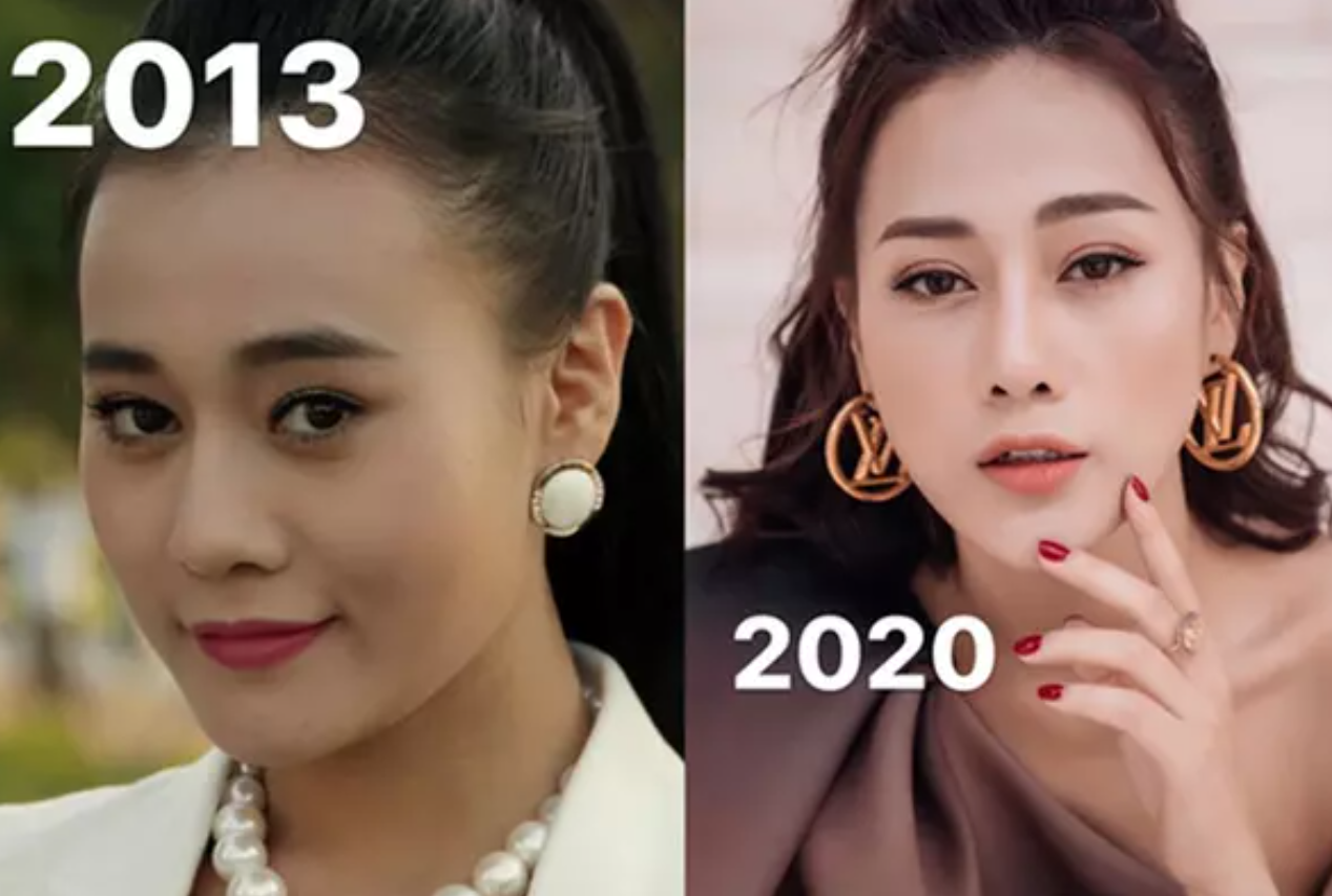 Rần rần hình ảnh Phương Oanh trước khi phẫu thuật thẩm mỹ, so với hiện tại nhan sắc ra sao? - Ảnh 4. Rần rần hình ảnh Phương Oanh trước khi phẫu thuật thẩm mỹ, so với hiện tại nhan sắc ra sao? - Ảnh 4.