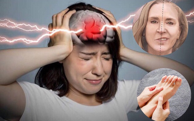 Nhờ “kén ăn” 3 món, người phụ nữ 46 tuổi thoát khỏi nhồi máu não: Cơ thể có 2/4 biểu hiện này phải đi khám ngay kẻo muộn