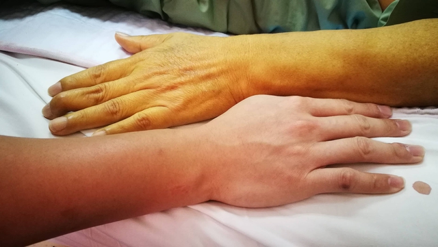 ‘2 vàng’ cảnh báo bệnh gan nhất định không được bỏ qua