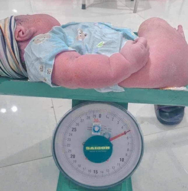 Sản phụ Nghệ An sinh thường con thứ 6 là bé trai nặng 5kg - Ảnh 1.