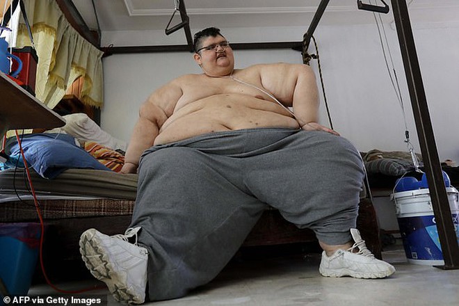 Chàng trai béo nhất thế giới từng nặng 575kg bây giờ ra sao sau phẫu thuật giảm cân? - Ảnh 4.
