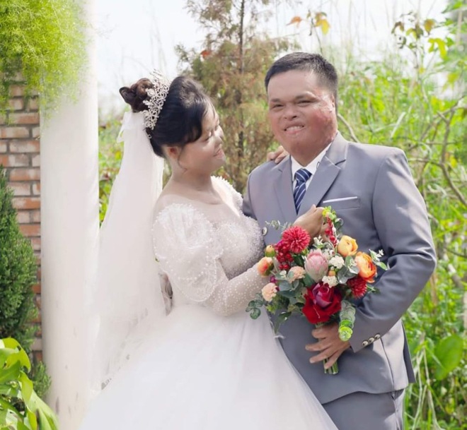 1 năm sau đám cưới cổ tích, người phụ nữ ở Phú Yên từng bị chồng cũ thiêu sống giờ ra sao? - Ảnh 3.