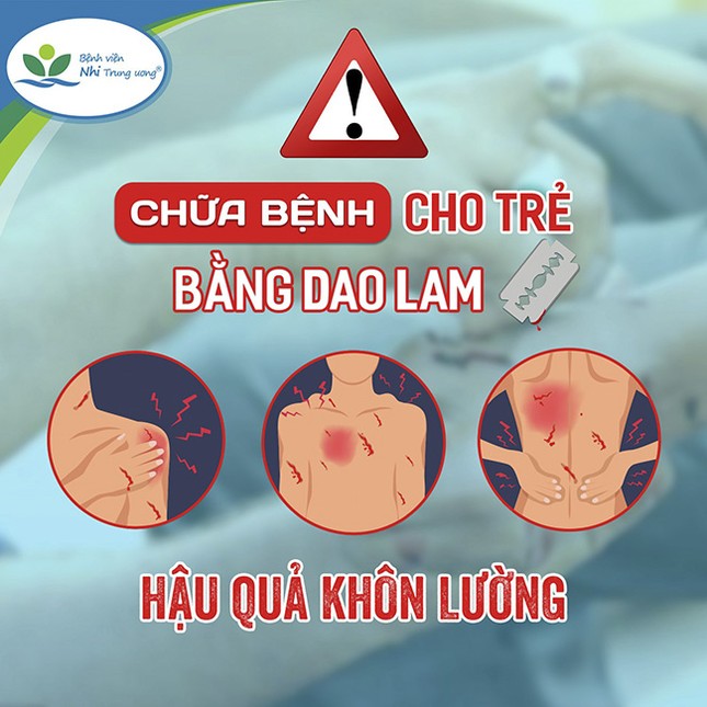 Trẻ tử vong vì người nhà rạch dao lam chi chít trên người để chữa bệnh - Ảnh 1.