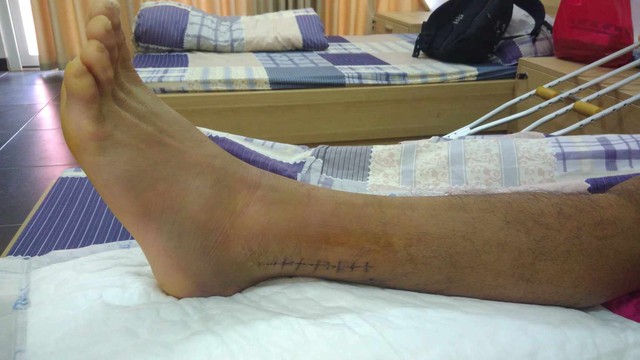 Đôi chân mang 6 chiếc đinh và màn lột xác ngoạn mục của tiền vệ Việt Nam từng dự U20 World Cup - Ảnh 3.