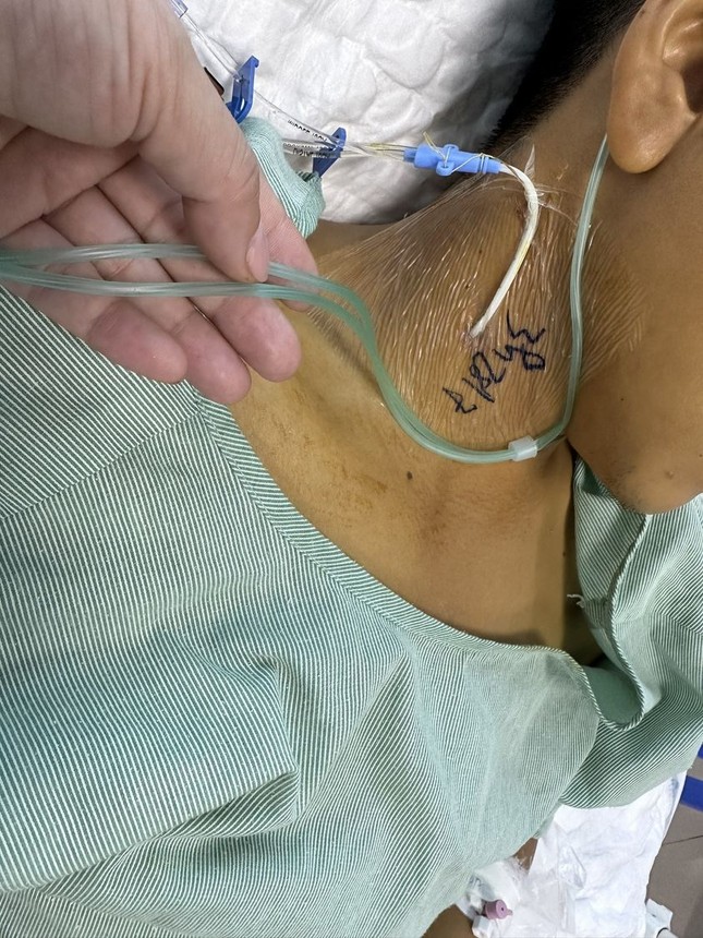 Lạng Sơn: Ngộ độc sau khi ăn xôi màu, 3 người cấp cứu - Ảnh 1. Lạng Sơn: Ngộ độc sau khi ăn xôi màu, 3 người cấp cứu - Ảnh 1.